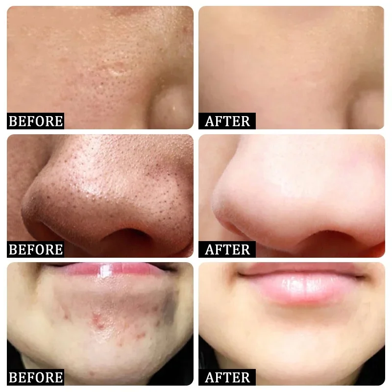 Salicylic Acid Pore Clearing C - Korean Skincare Routine review and price