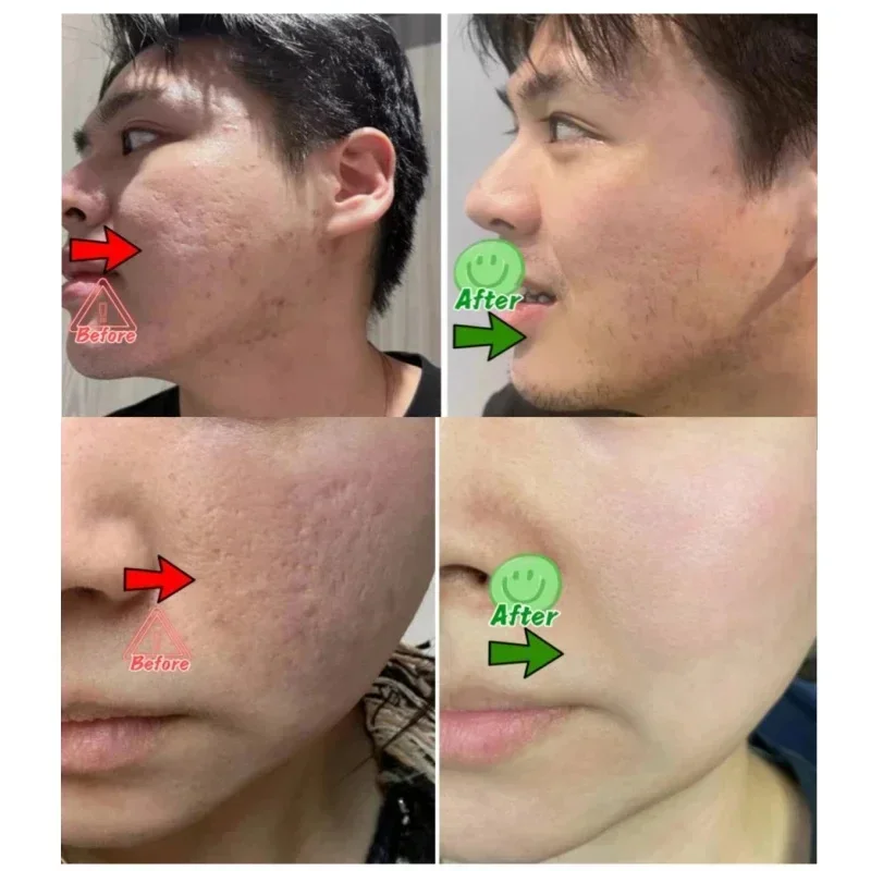 Salicylic Acid Pore Clearing C - Korean Skincare Routine review and price