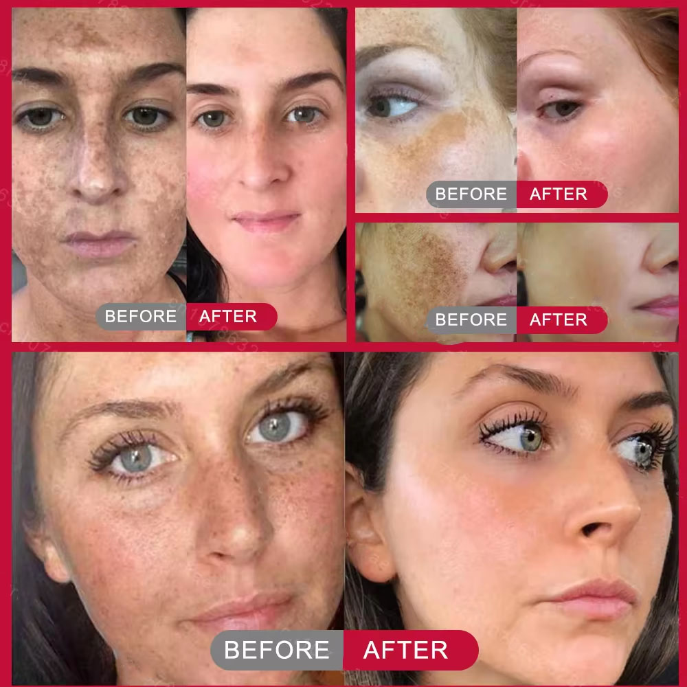 Powerful Spot-removing Whiteni - Korean Skincare Routine review and price